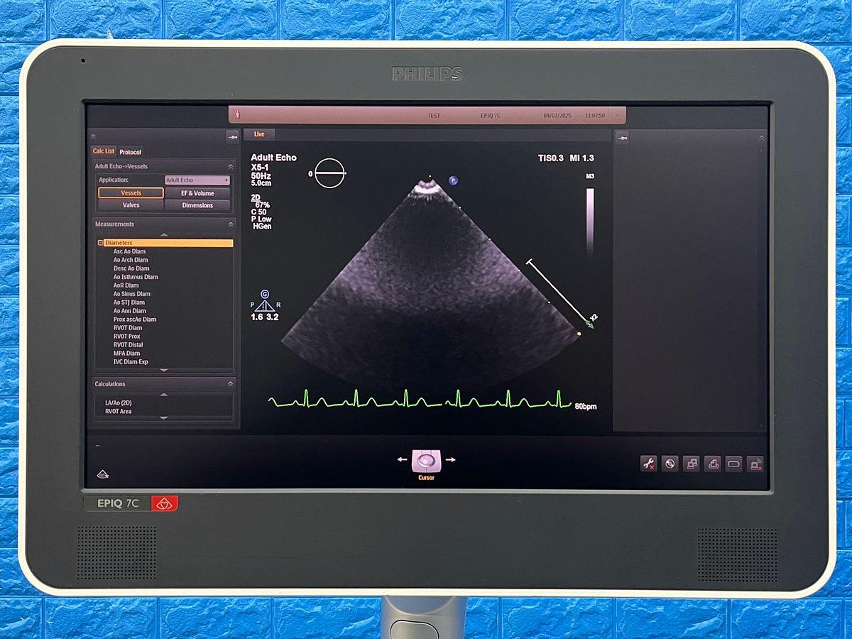 Used Philips EPIQ 7C Ultrasound  SW: HW A.1 YOM: 2016 SN: US616B0913 Probe  X5-1 