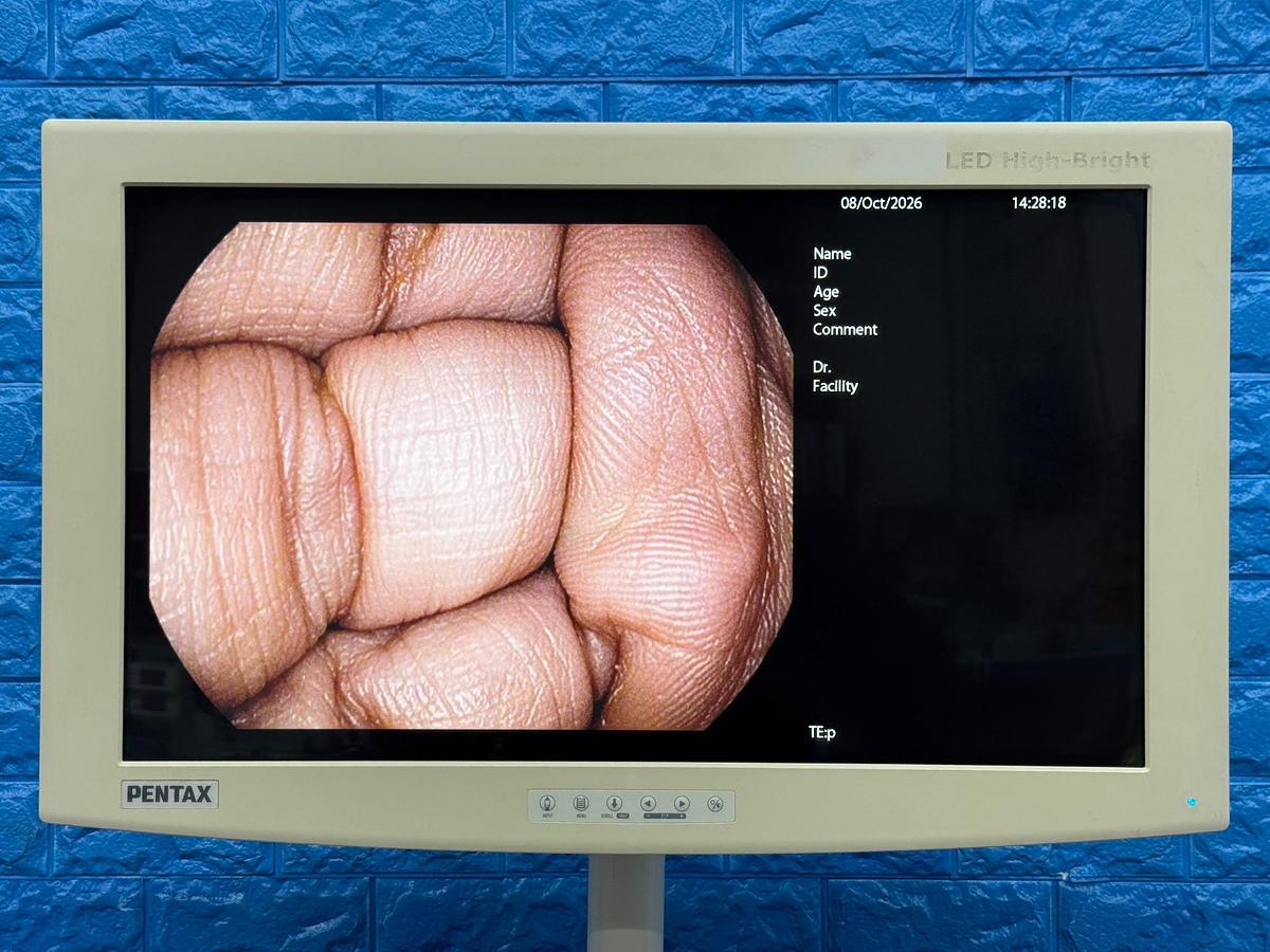 Used Pentax EPK-i7000 Complete Endoscopy Tower with Gastroscope & Colonoscope YOM 2013