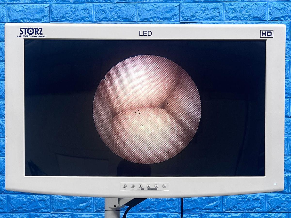 Used RICHARD WOLF 7305.006 Cystoscope Endoscopy Scope