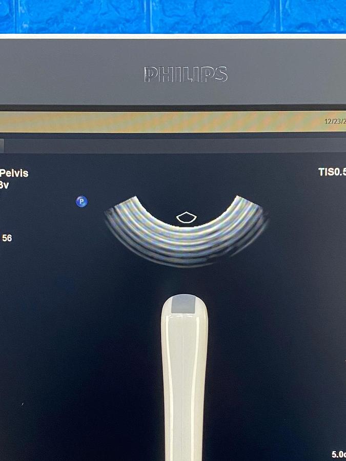 Used Philips Affiniti 70G PureWave Software Version: 9.0.16 Hardware B.0 YOM: 2018 Probes L15-7io C10-3v C9-2 C5-1