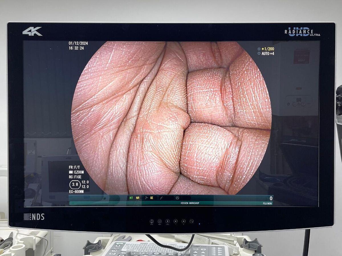 Used FUJINON EC-600WM Scope