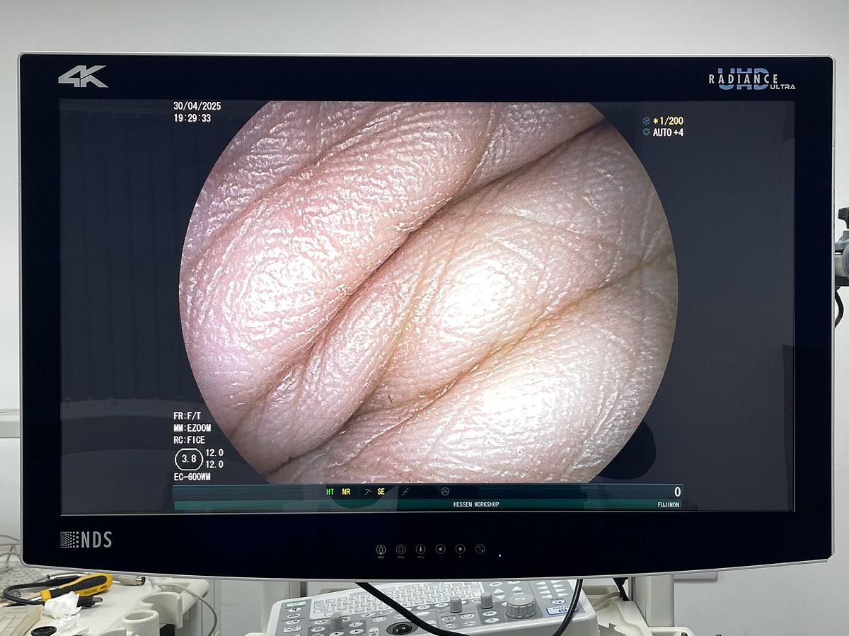 Used FUJINON Scope Model: EC-600WM Colonoscope Colonoscope