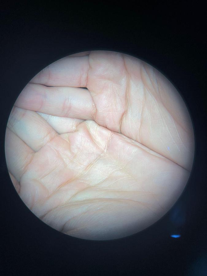 Used ZEISS Stativ S88 OPMI VARIO Microscope