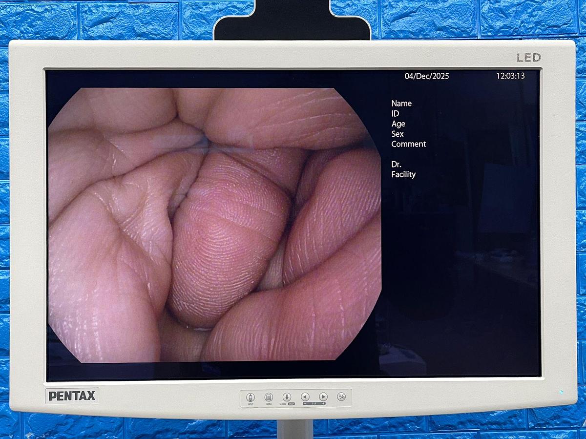 Used Pentax tower Pentax Processor : EPK- i7000 YOM: 2013 Include Pentax OS-A61 Foot Switch  Sony Colour Printer  Water Bottle