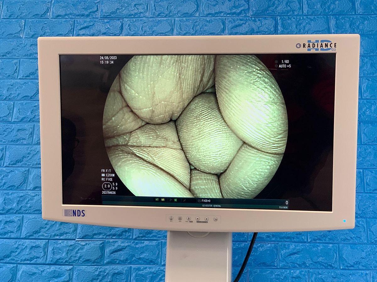 Used FUJINON EG-580NW