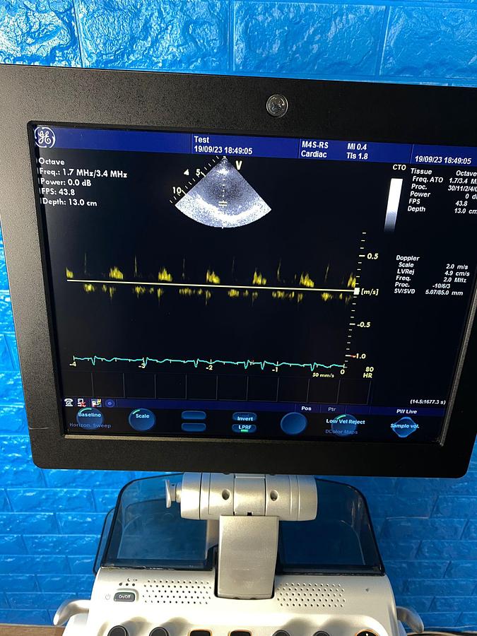 Used GE VIVID S6 YOM: 2013 Includes: M4S Cardiac Probe