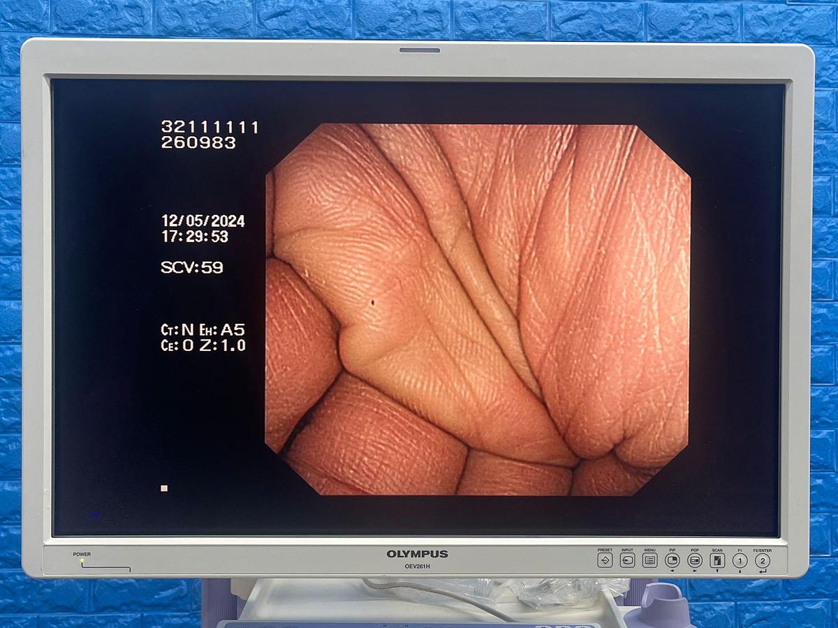 Used  Olympus scope  Model: CF-H260DL 