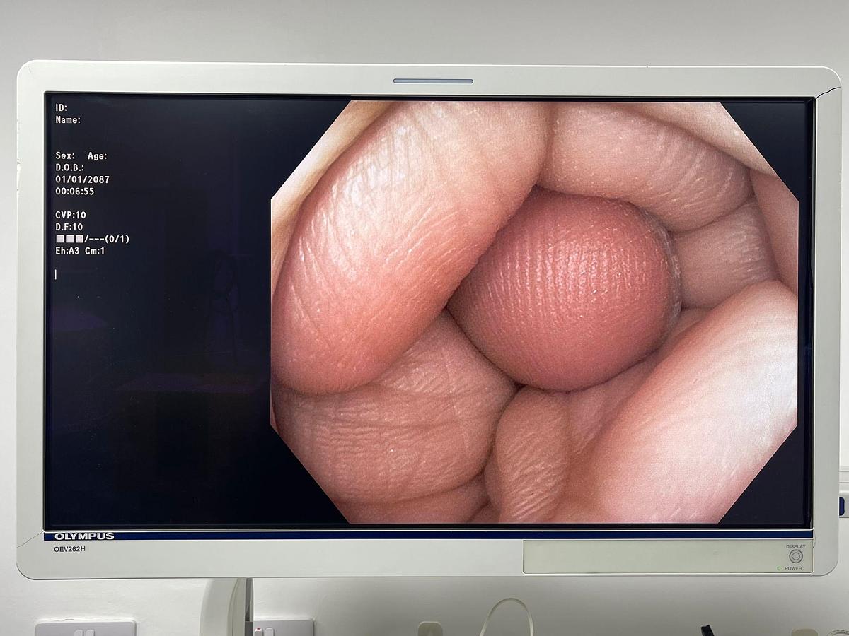 Used Olympus Scope Model: CF-HQ190L