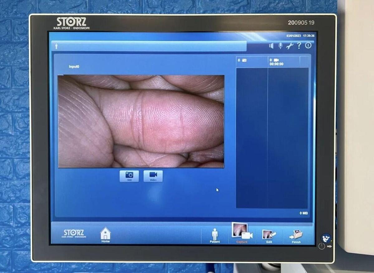 Used Karl Storz Image 1 Hub 222010 20 complete tower with Karl Storz H3-Z camera head.