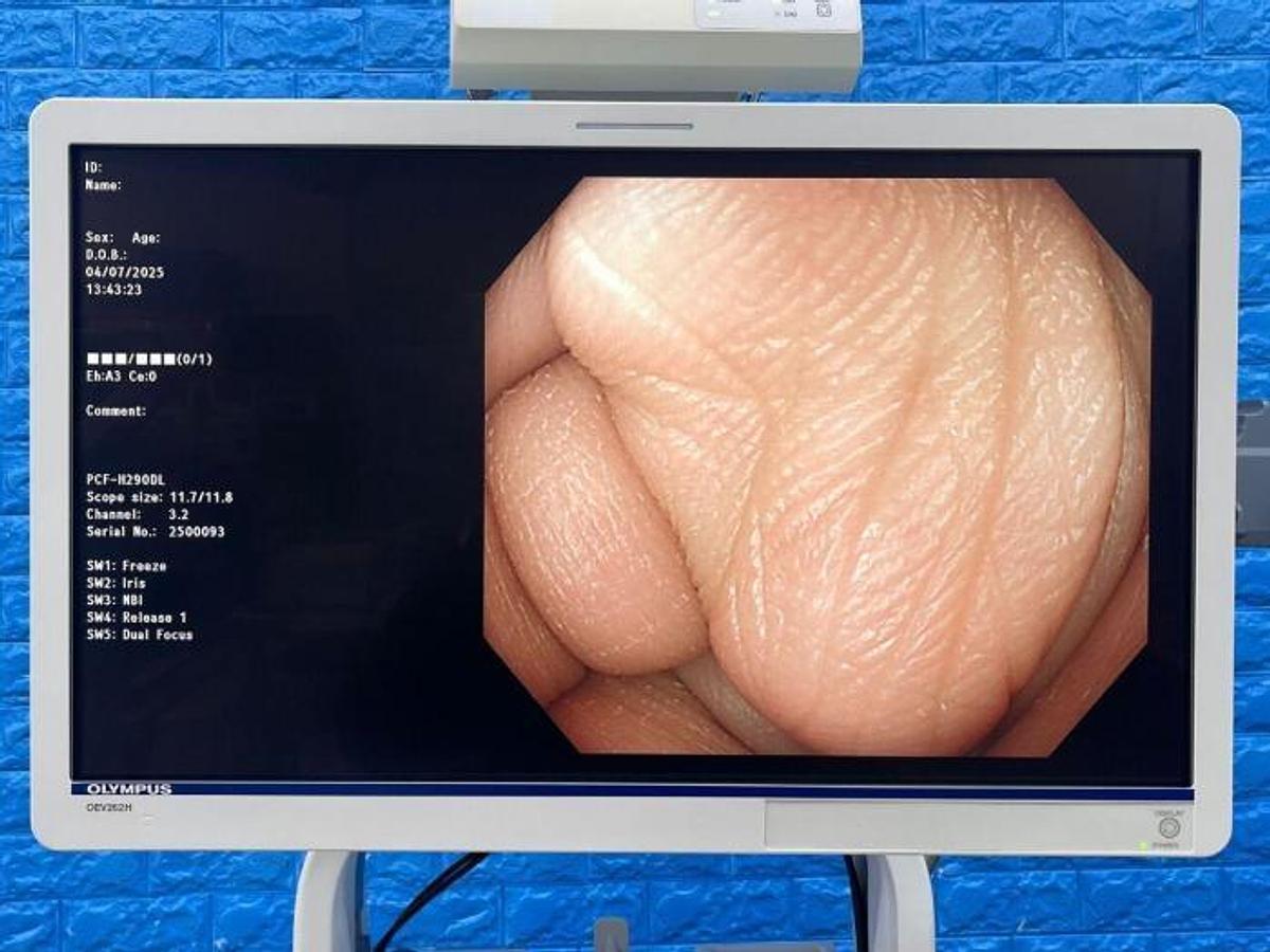 Used - OLYMPUS PCF-H290DL