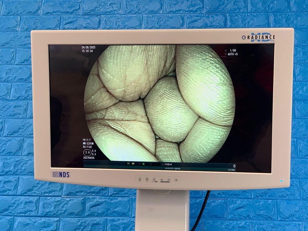 Used FUJINON EG-580NW