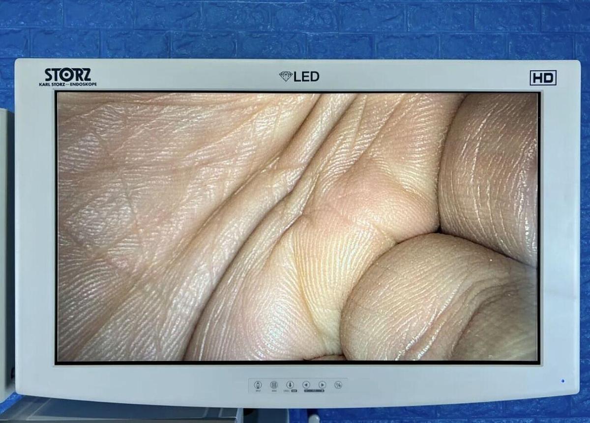 Used Karl Storz Image 1 Hub 222010 20 complete tower with Karl Storz H3-Z camera head.