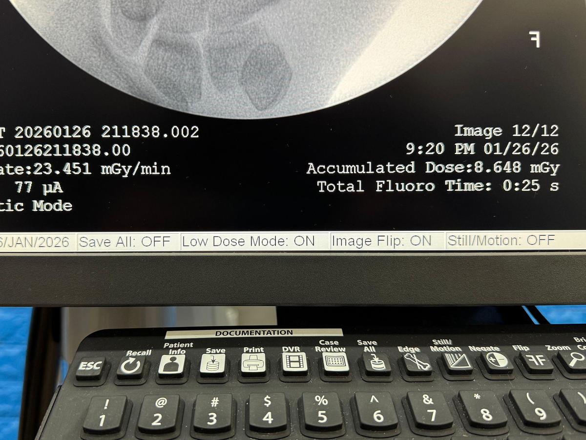 Used OrthoScan High Definition Mini C-Arm X-Ray Model: 1000-0004 YOM: 2011 SN: 5E1155