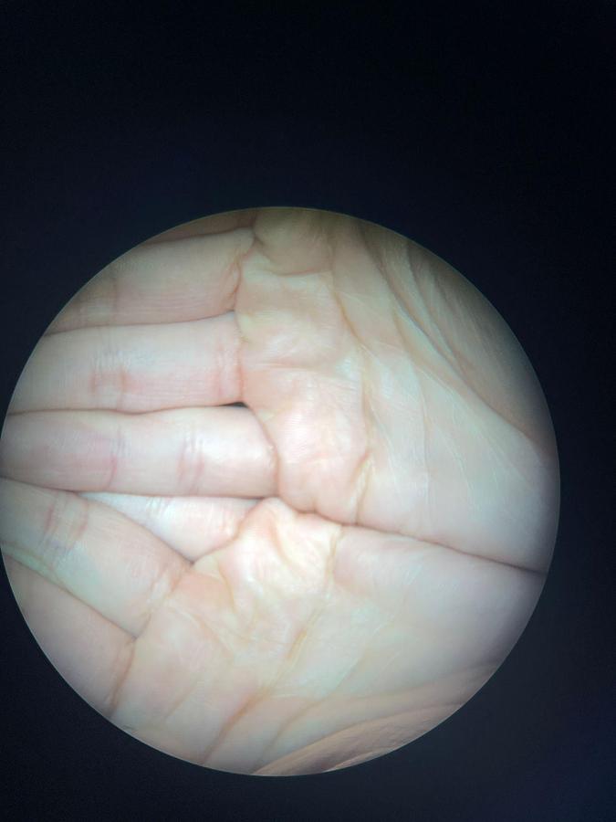 Used ZEISS Stativ S88 OPMI VARIO Microscope