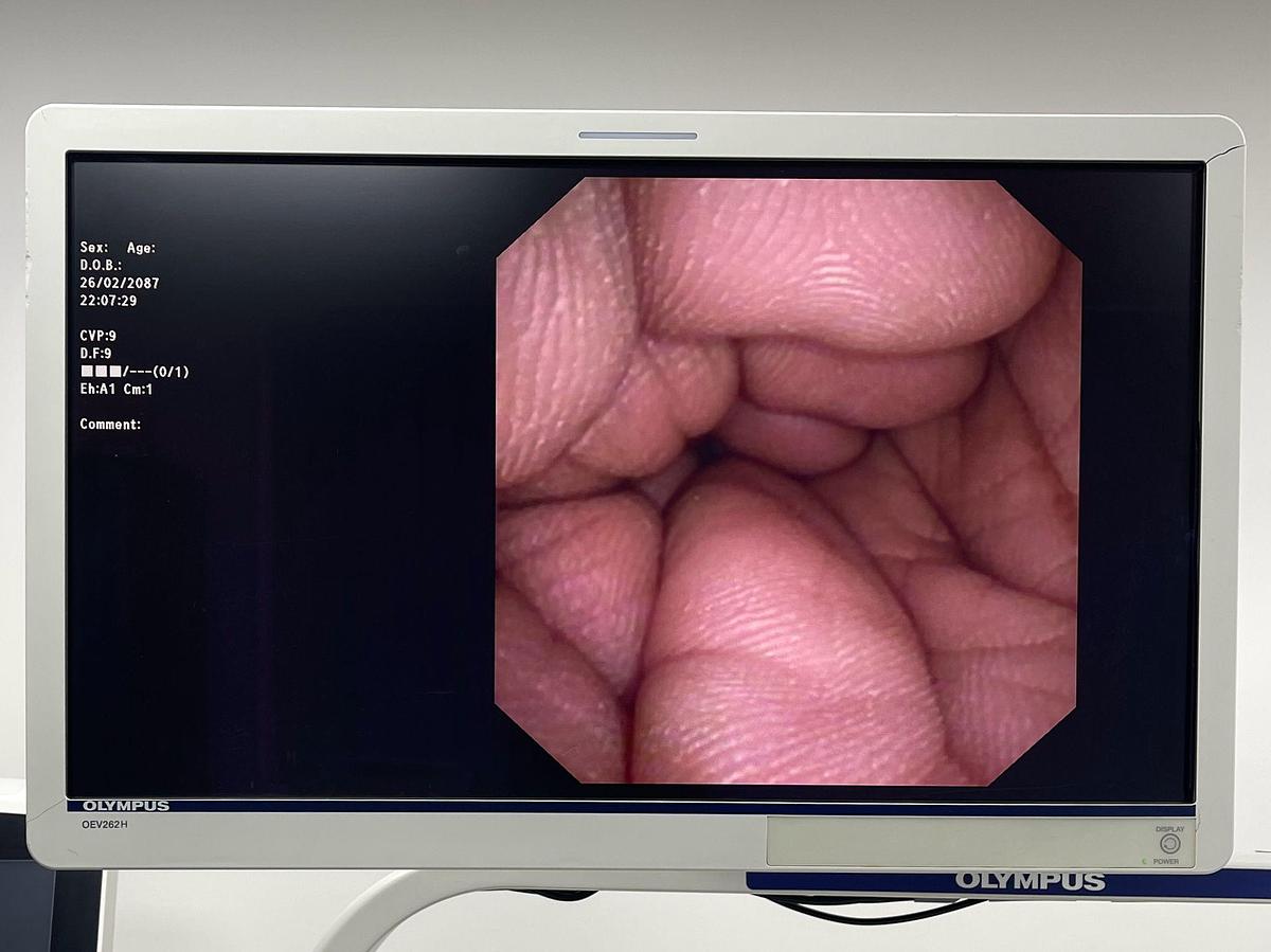 Used Olympus Scope Model: CYF-VA