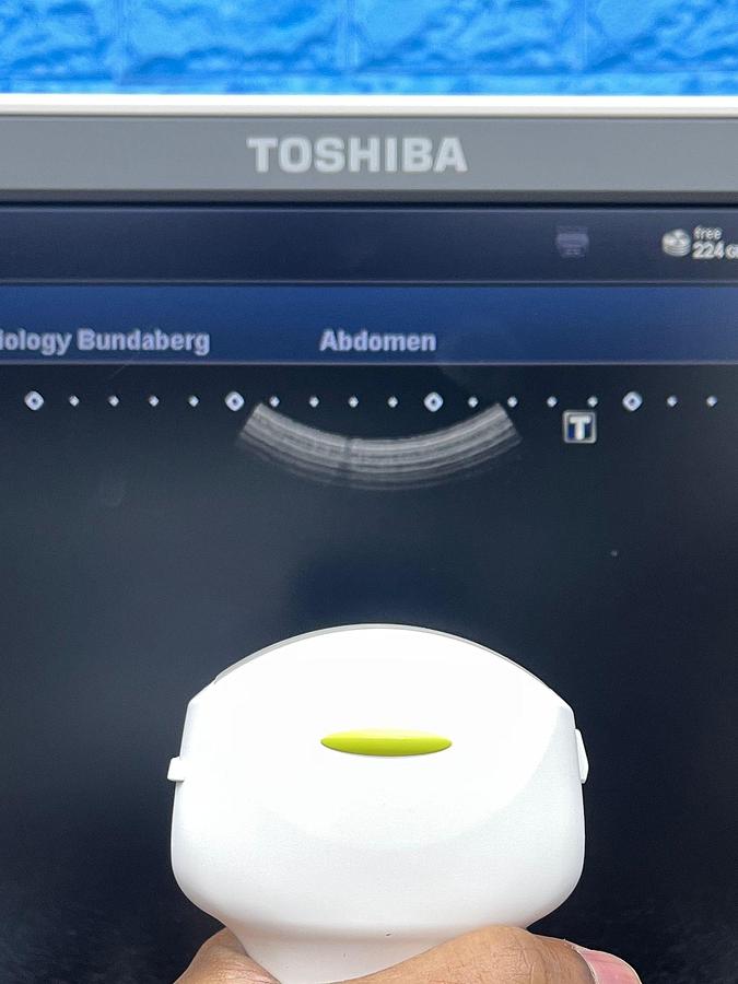 Used TOSHIBA Ultrasound Aplio 500 YOM: 2016