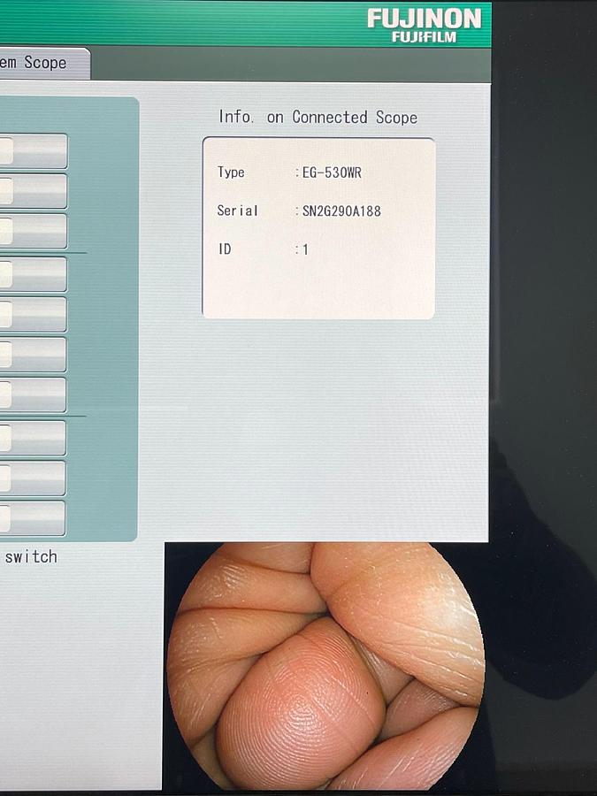 Used FUJINON Scope Model: EG-530WR