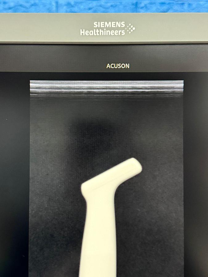 Used Siemens Healthineers Acuson Juniper Ultrasound YOM: 2018 Probe 10V4 YOM: 2018 16L4 YOM: 2019 18H5 YOM: 2018