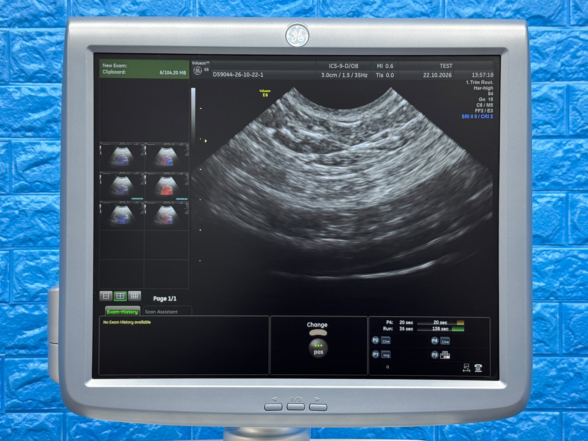 Used GE Voluson Е6 Ultrasound YOM: 2013