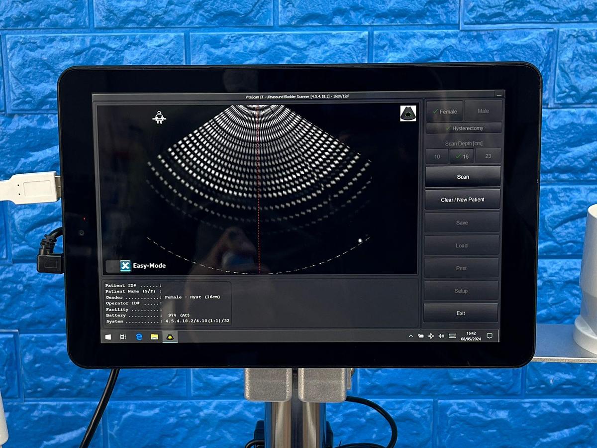 Used Vitacon VitaScan LT Urology Ultrasound With Vitascan V2 Probe.