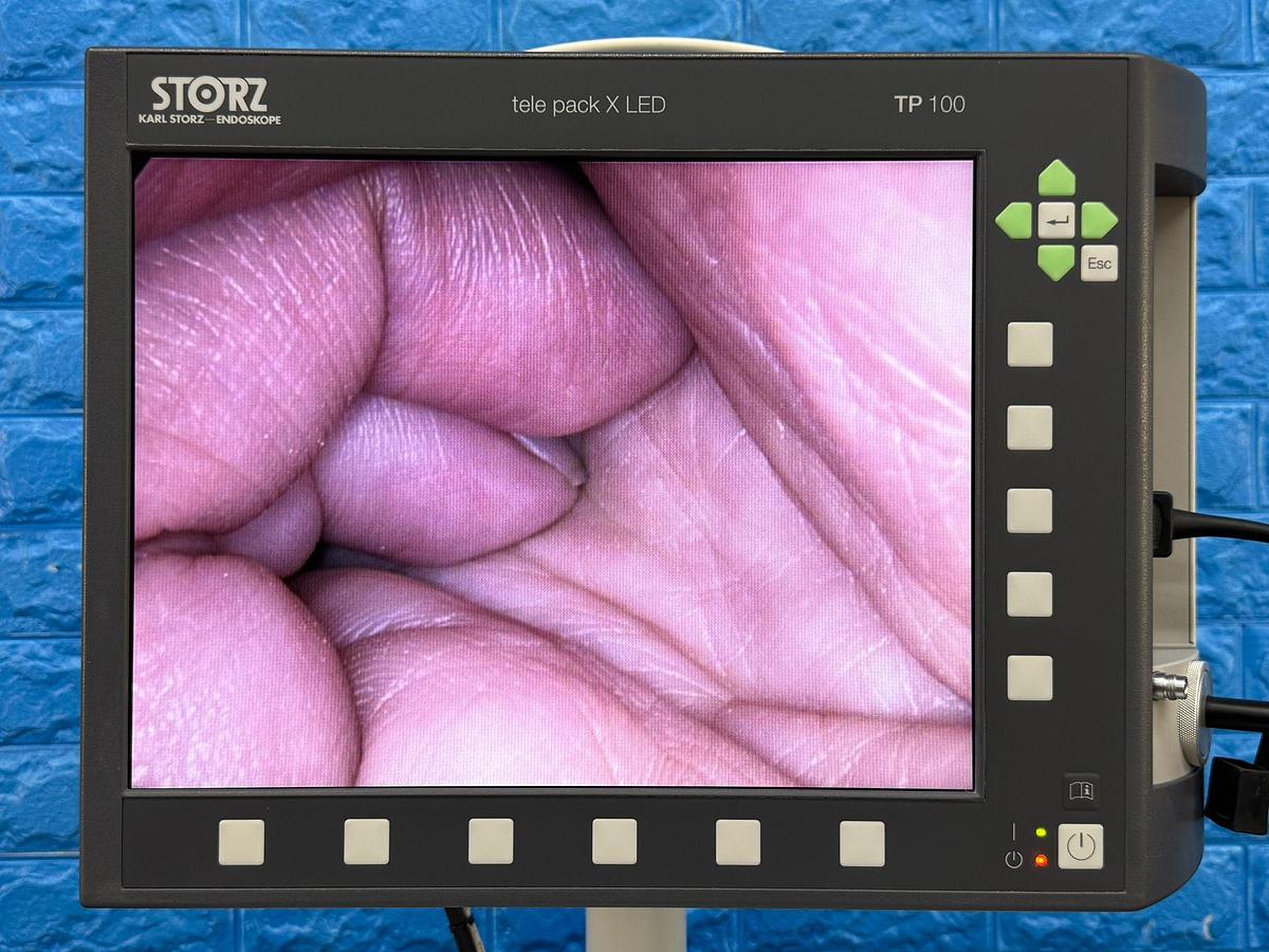 Used Karl Storz Tele Pack X LED TP 100  