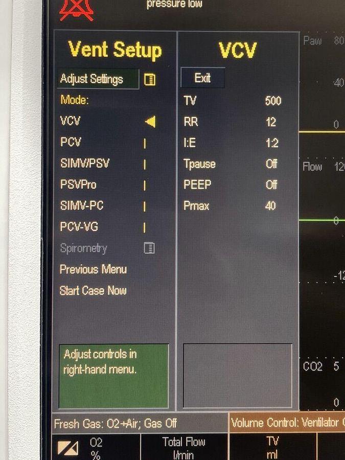 Used GE DATEX-OHMEDA S/5 Anesthesia YOM