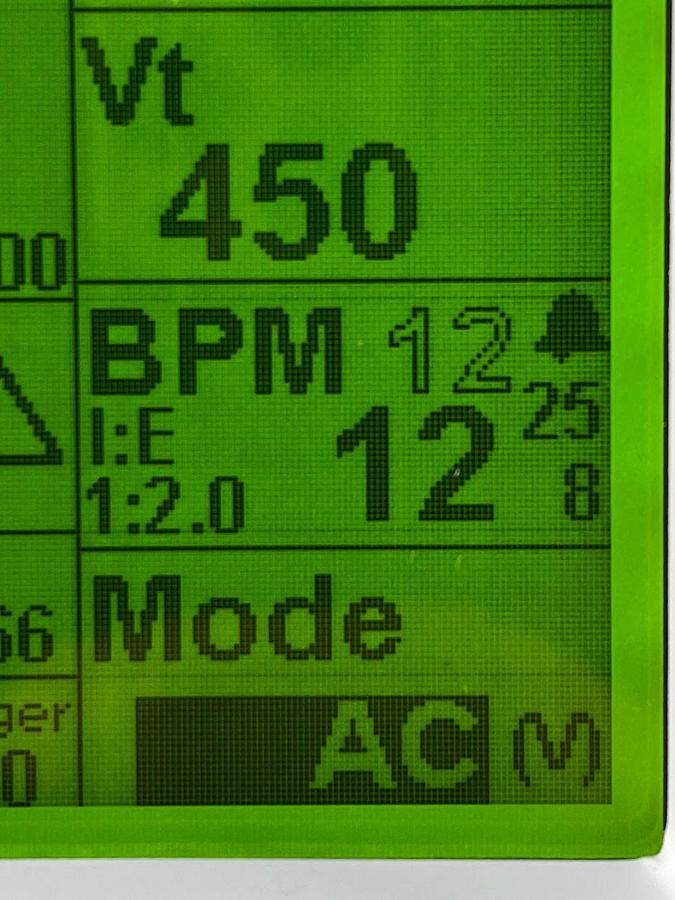 Used Zoll 731 Series Ventilator YOM: 2019 -4 pieces