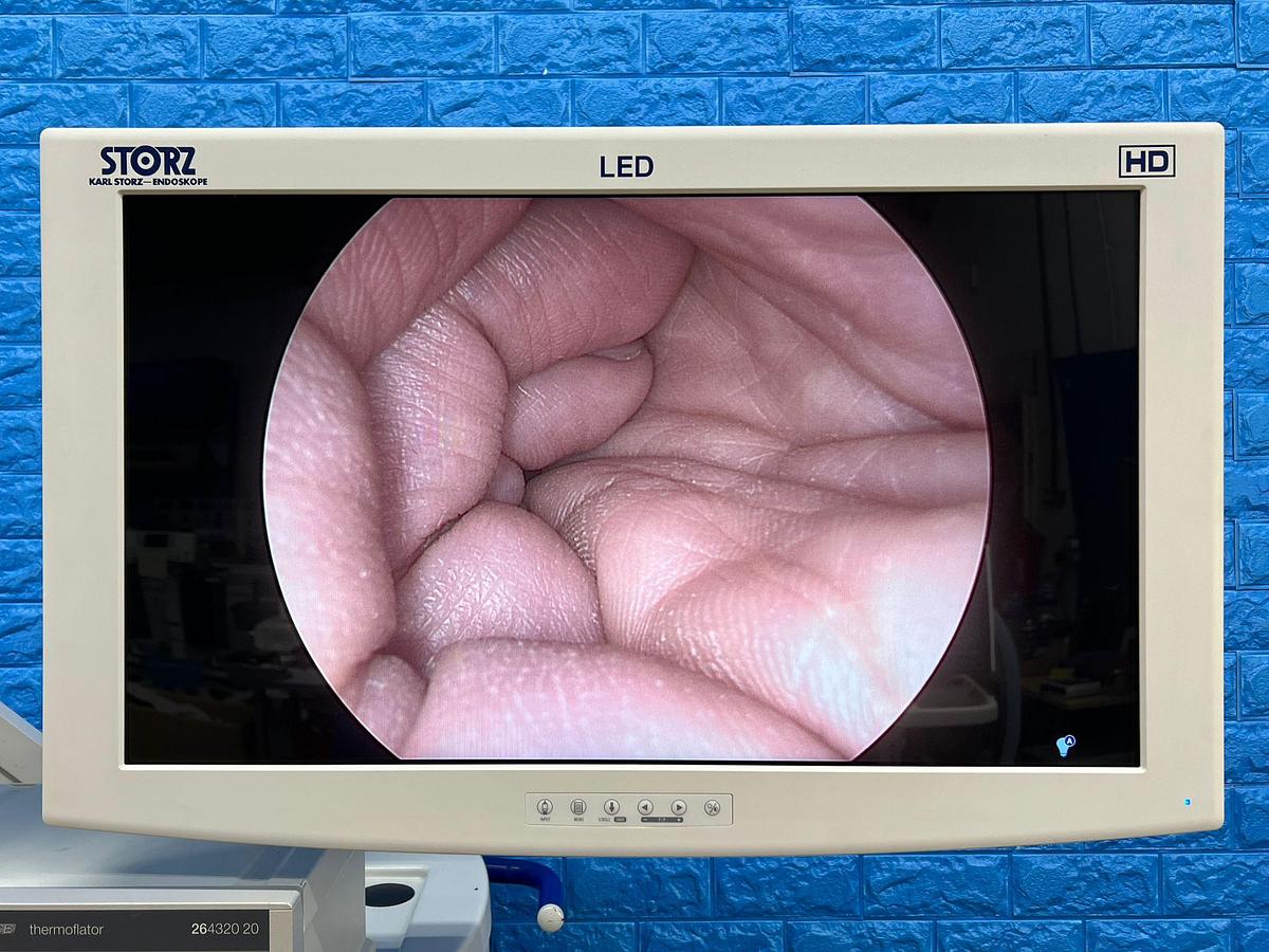 Used KARL STORZ Spies Tower Laparoscope