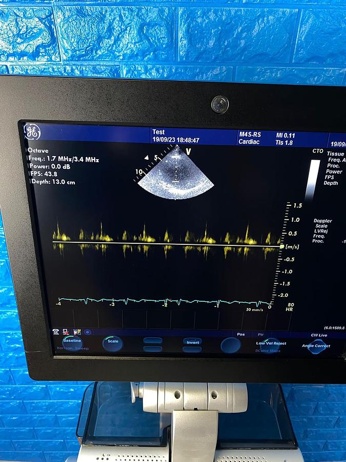 Used GE Vivid S6 Cardiovascular ultrasound system YOM: 2013