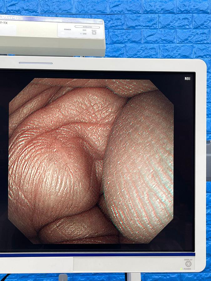 Used Olympus GIF-XP290N Gastroscope