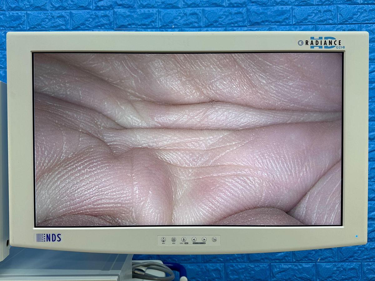 Used Karl Storz Spies Tower: -LCD Monitor 26 Inch  -Aida Monitor 19 Inch Touch Screen -Endoflator with Hose  -Keyboard -Camera Head H3-Z Spies S Full HD TH100  -Aida Control WD 200 -Xenon 300 Light source  -Spies S TC200/TC300 -Sony Printer