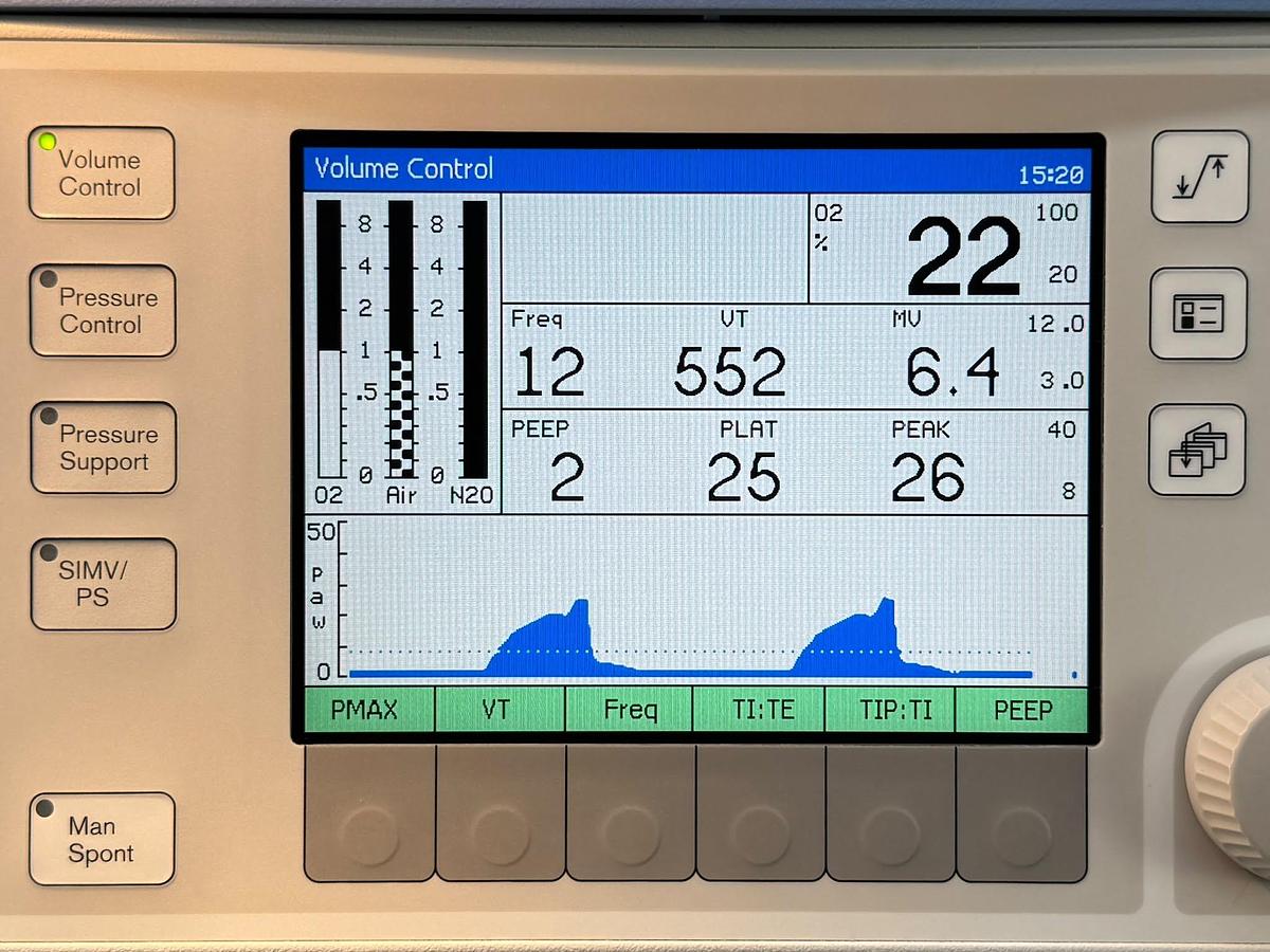 Used Dräger Fabius Tiro YOM: 2011 SN: ASCC-0212 Include GE B650 Patient Monitor YOM: 2013 SN: SEW13244968HA With SPO2 & ECG Cables