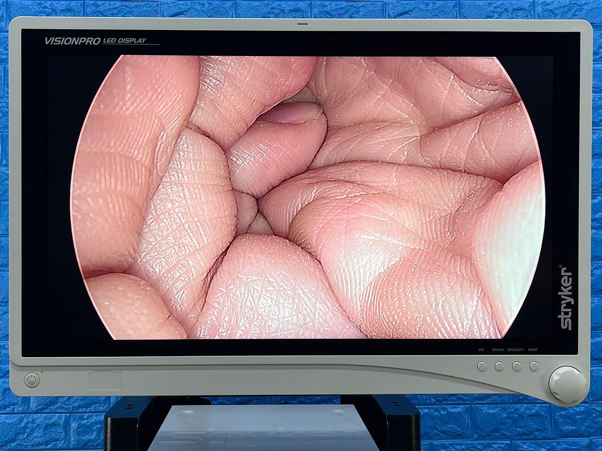 Used STRYKER 1488 Full HD Tower Laparoscope