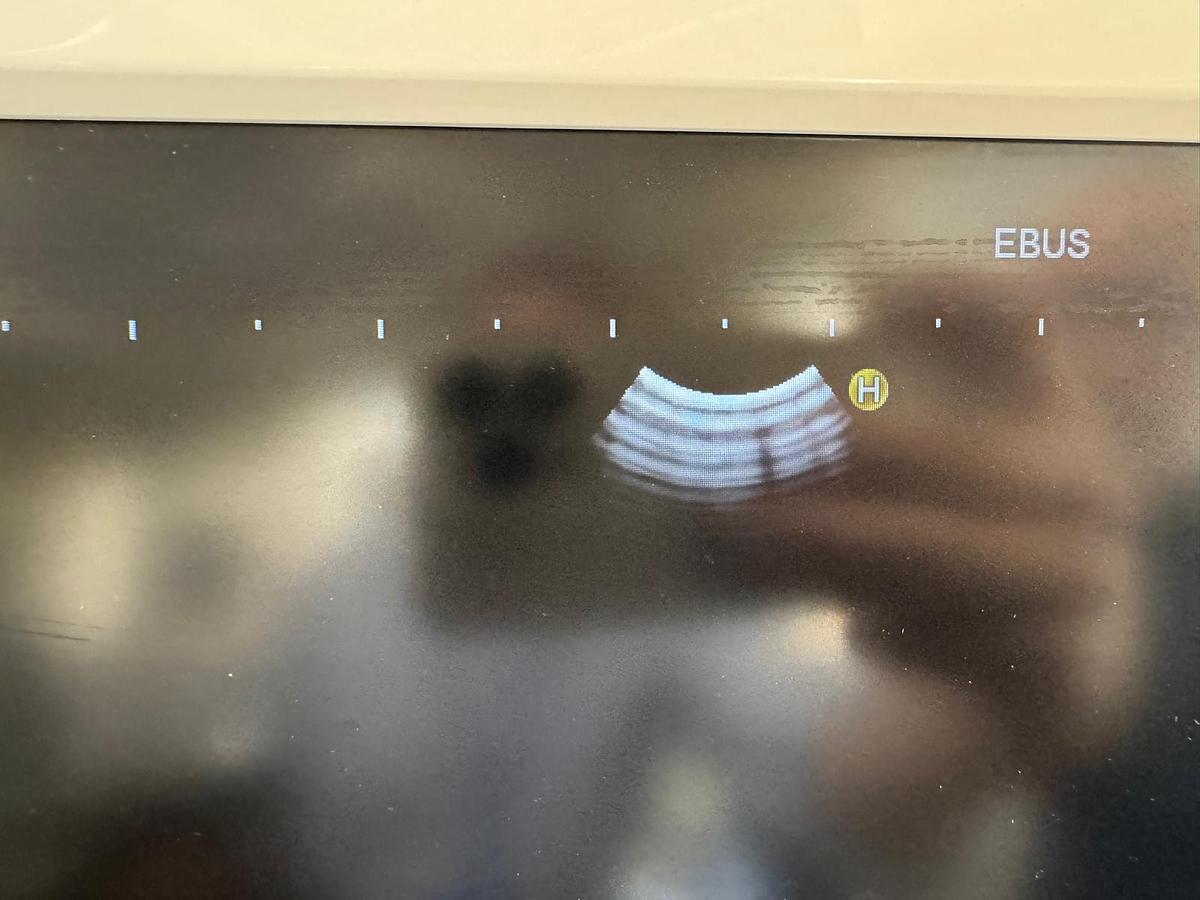 Used Pentax Scope Model: EB-1970UK Bronchoscope