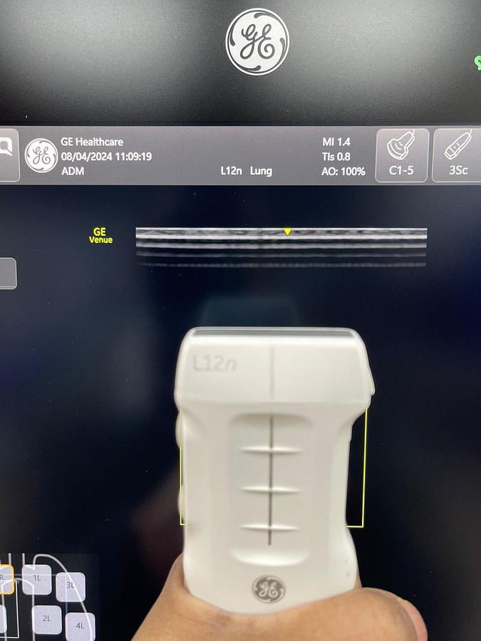 Used GE Venue YOM: 2018 With 3 Probes.