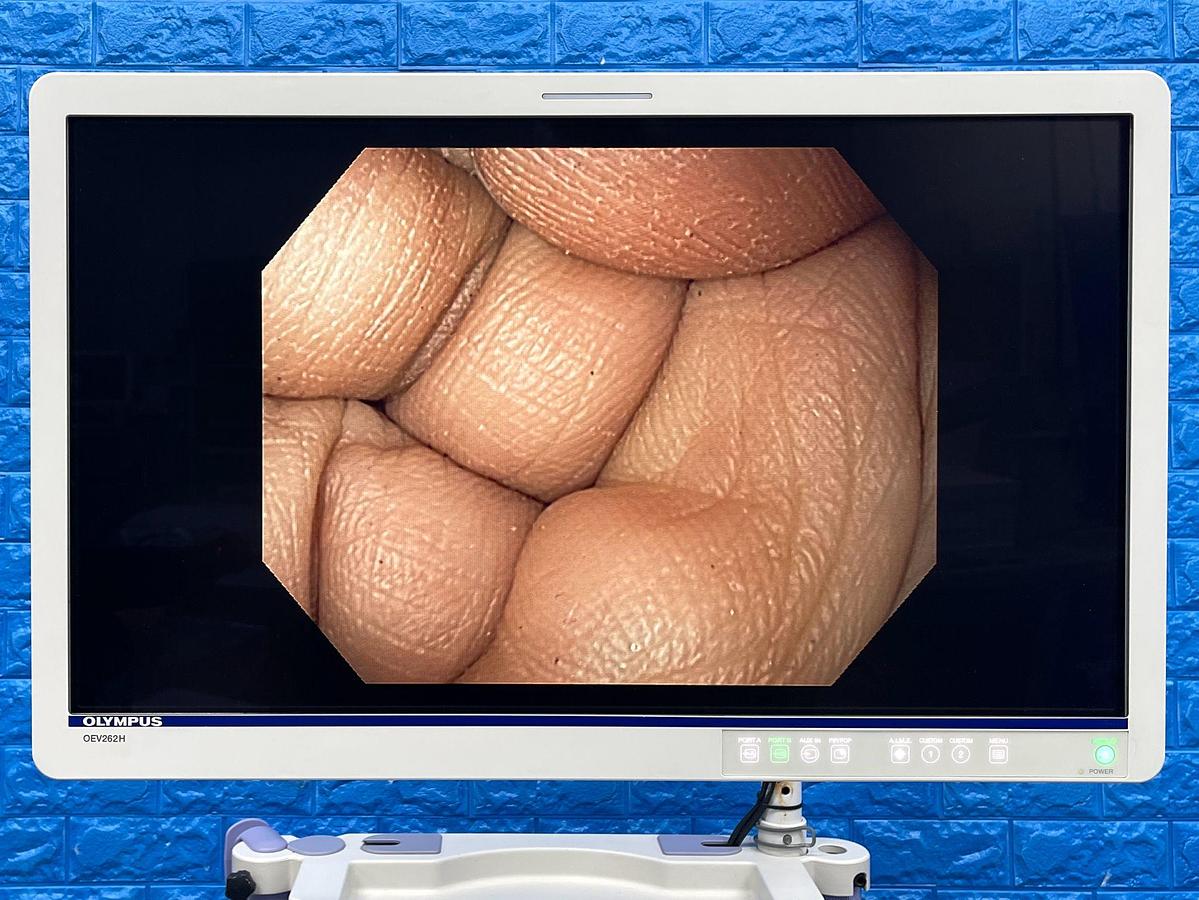 Used OLYMPUS CV-180/CLV-180 Tower with 2x Endoscopes