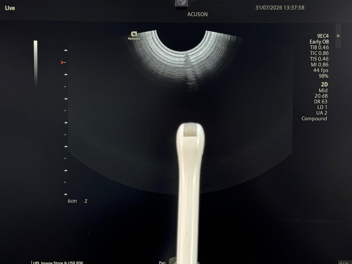 Used Siemens Acuson Redwood Diagnostic Ultrasound REF: 11503314 YOM: 2022 Probes 9C3 YOM: 2025 7VC2 YOM: 2021 9EC4 YOM: 2022