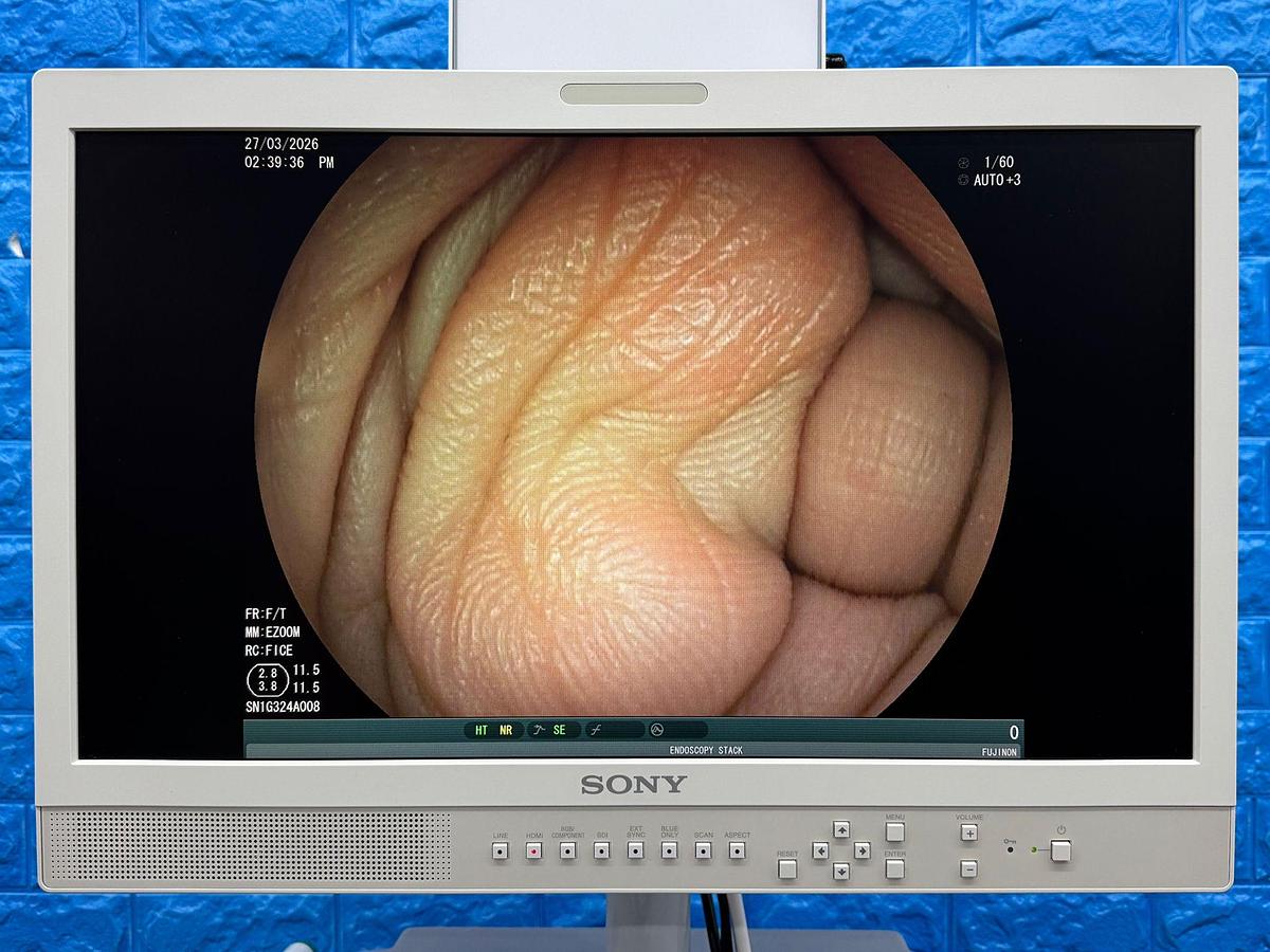 Used Fujinon Scope  Model: EG-530D 