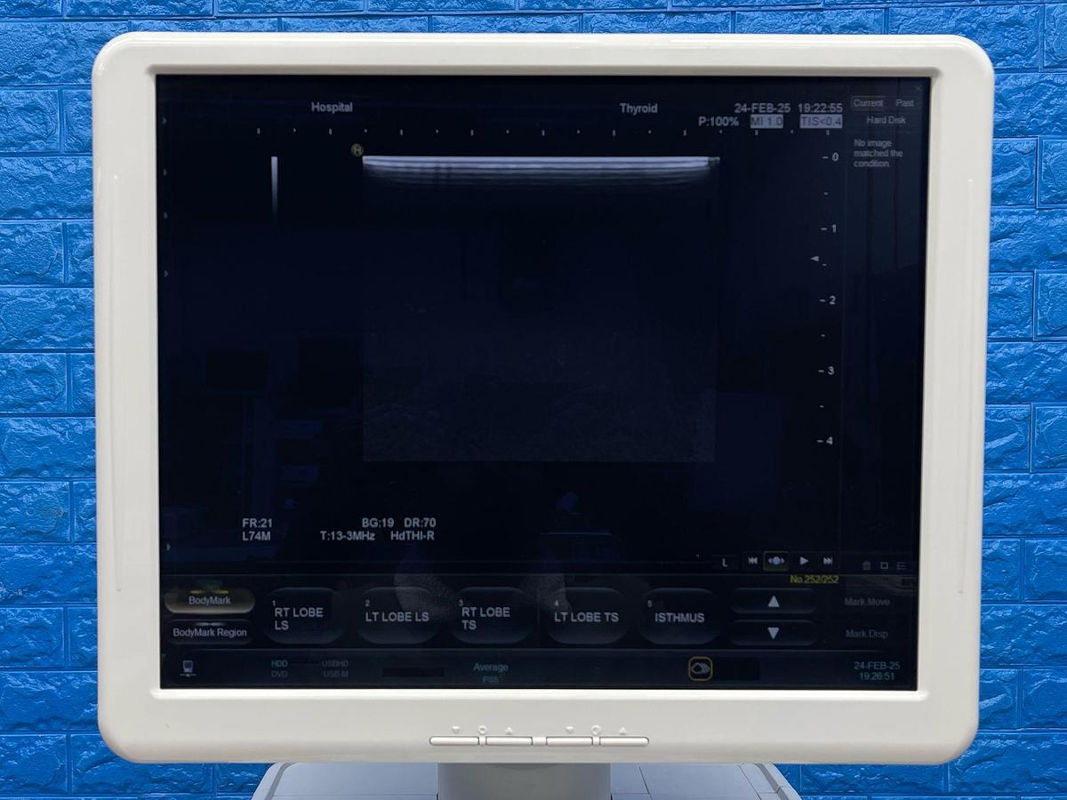 Used Hitachi HI VISION Ascendus Ultrasound YOM: 2016