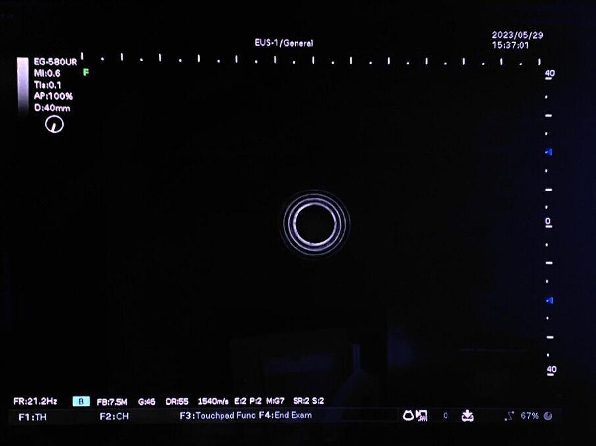 Used FUJINON EG-580UR