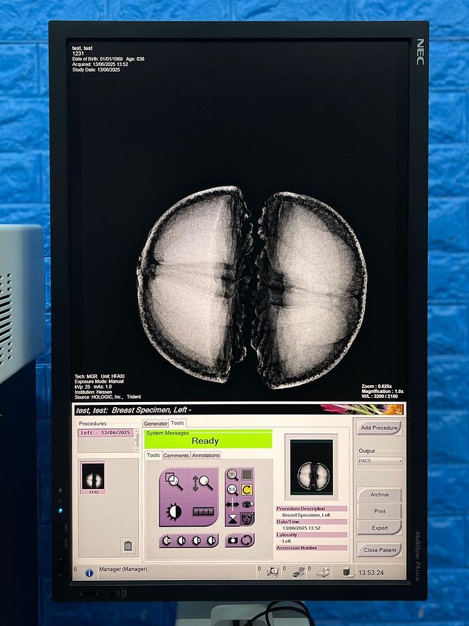 Used HOLOGIC Trident Specimen Radiography System YOM: 2012