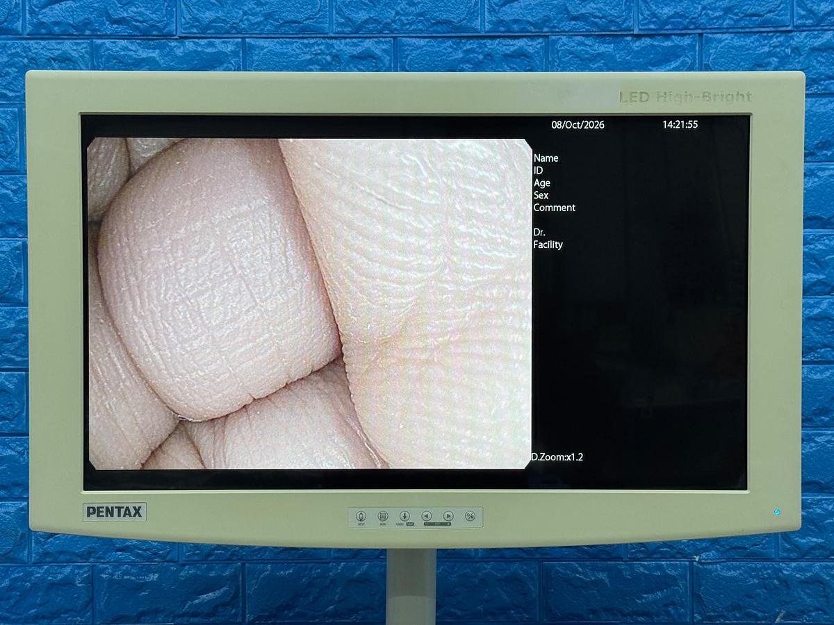 Used Pentax EPK-i7000 Complete Endoscopy Tower with Gastroscope & Colonoscope YOM 2013