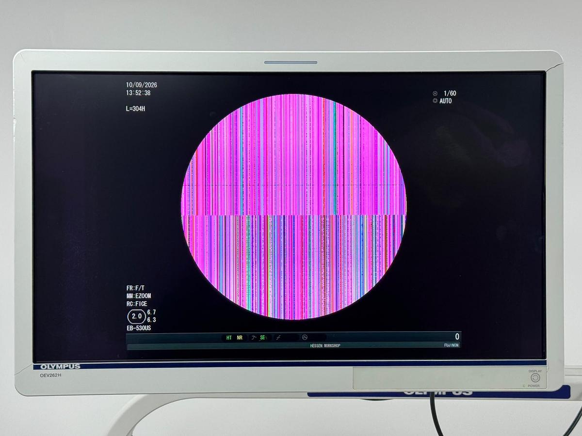 Used Fujinon Scope Model: EB-530US Bronchoscope YOM: 2016