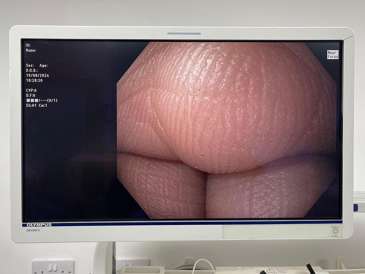 Used OLYMPUS Scope Model: GIF-HQ190 