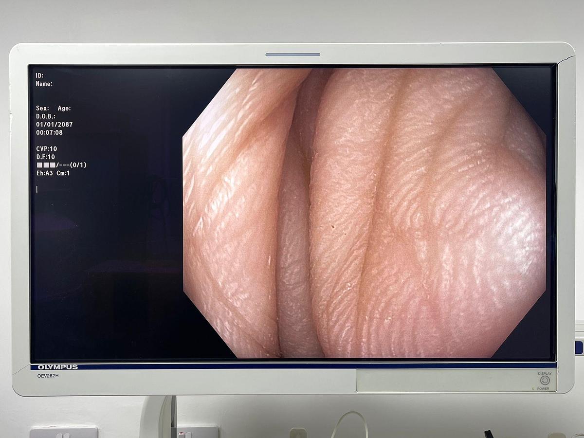 Used Olympus Scope Model: CF-HQ190L