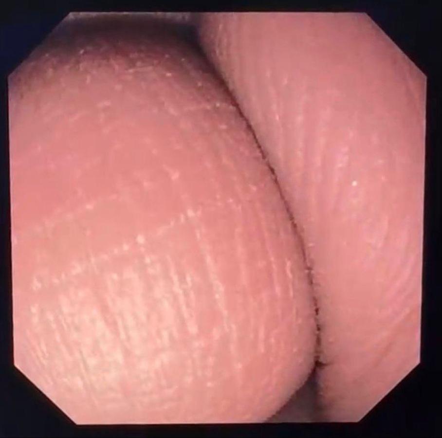 Olympus TJF-Q190V Duodenoscope