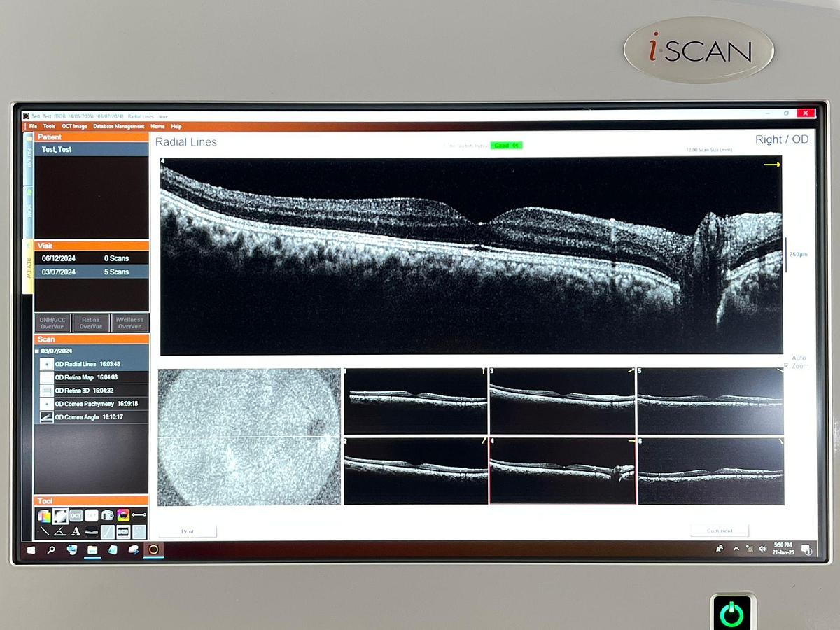 Used OPTOVUE IVUE 500 YOM: 2021 OCT