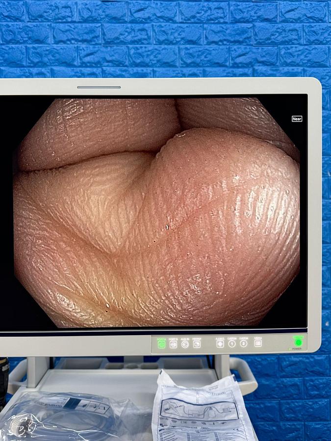 OLYMPUS-Evis-X1-CV-1500-Endoscopy-Tower 