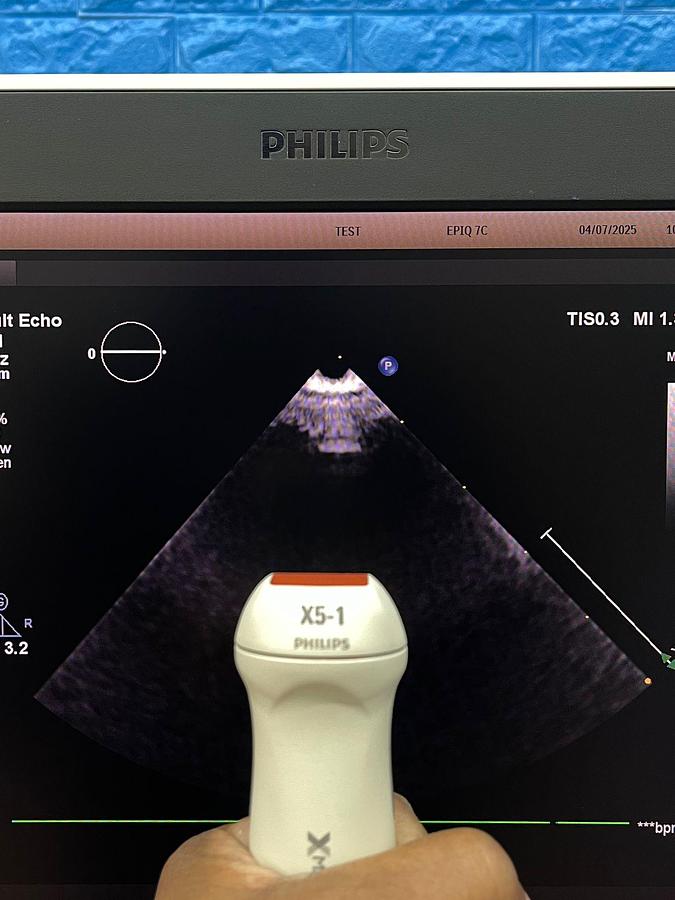 Used Philips EPIQ 7C Ultrasound  SW: HW A.1 YOM: 2016 SN: US616B0913 Probe  X5-1 