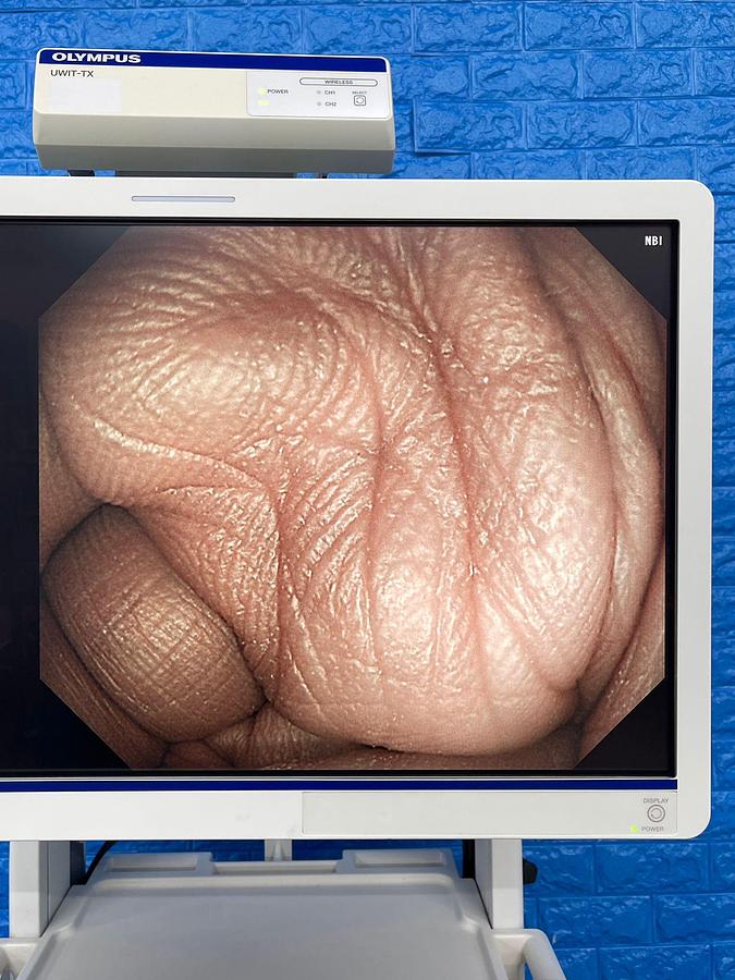 Used Olympus scope Model: GIF-HQ290